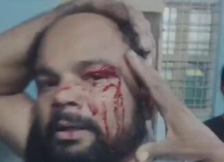 #Jhansi विवाद में हस्तक्षेप पर आटो चालक पर चाकू से हमला